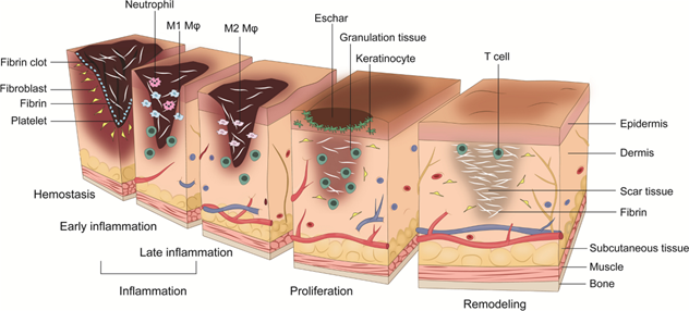پروسه فیزیوپاتولوژی زخم